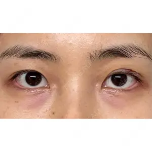 オアシス美容外科口コミ