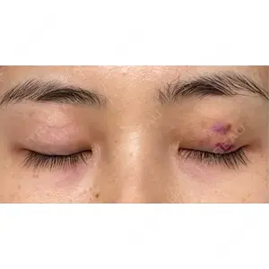 オアシス美容外科口コミ