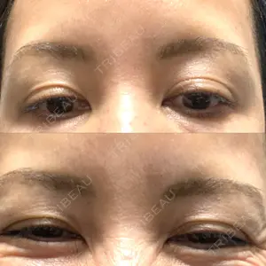 TCB東京中央美容外科 神戸院の