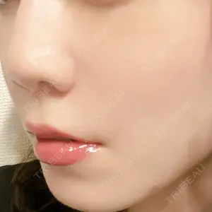 L‘amour clinic Tokyo【ラムールクリニック東京】口コミ