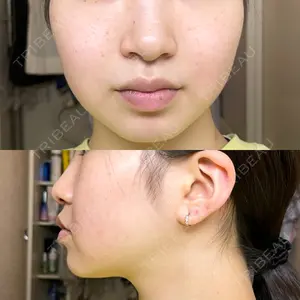 口コミ