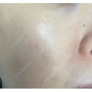 ミニマムスキンクリニック ミニマムスキンクリニック池袋口コミ