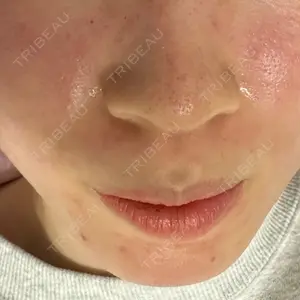 ルラ美容クリニック ルラ美容クリニック 札幌院口コミ