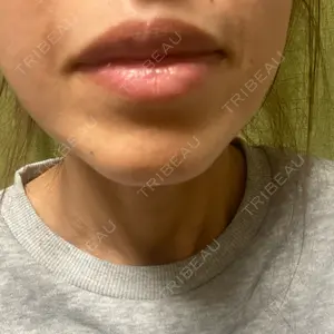 ルラ美容クリニック ルラ美容クリニック 渋谷本院口コミ