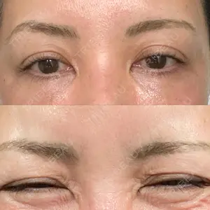 TCB東京中央美容外科 神戸院の