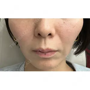 おおかみ美容のクリニック おおかみ美容のクリニック 新宿院口コミ