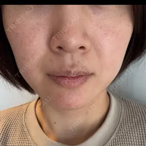 APスキンクリニック銀座口コミ