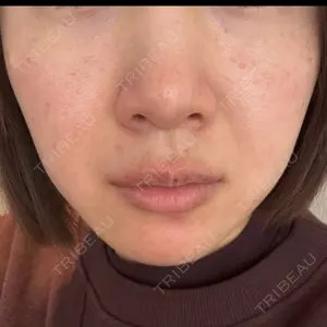 APスキンクリニック銀座口コミ