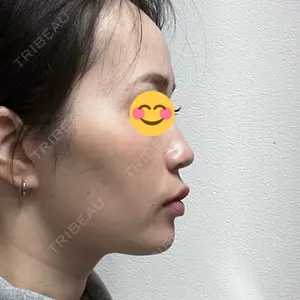口コミ