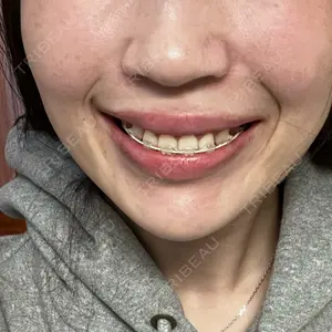 APスキンクリニック銀座口コミ
