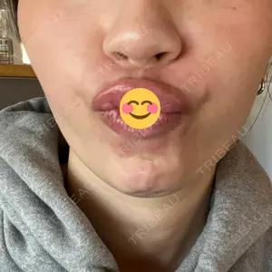 APスキンクリニック銀座口コミ