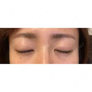 ミニマムスキンクリニック ミニマムスキンクリニック池袋口コミ