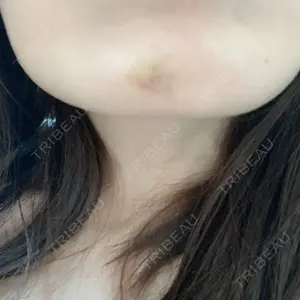 口コミ