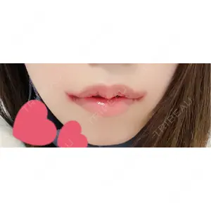 R Beauty CLINIC R Beauty CLINIC 銀座院口コミ