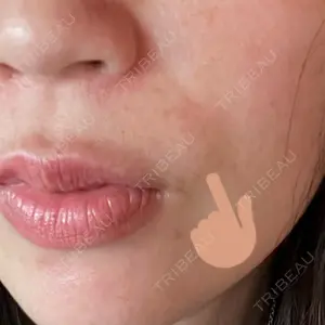 APスキンクリニック銀座口コミ
