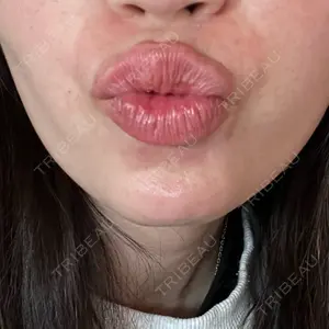 APスキンクリニック銀座口コミ