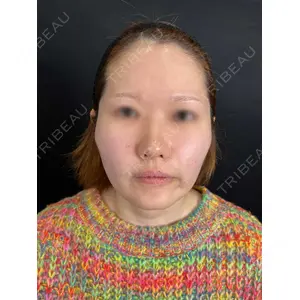 藤・ナチュレ美容クリニック 藤・ナチュレ美容クリニック 銀座院口コミ