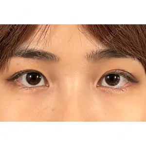 オアシス美容外科口コミ