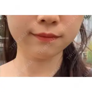 YBC横浜美容外科 YBC横浜美容外科 立川院口コミ