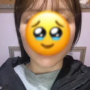 グランジョイクリニック口コミ
