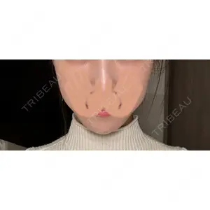 口コミ