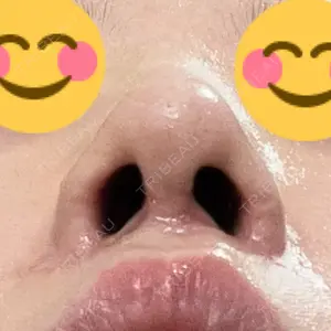 口コミ