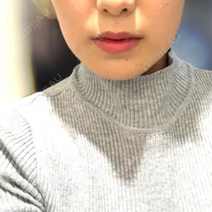 BiBiクリニック口コミ