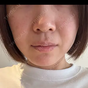 APスキンクリニック銀座口コミ