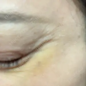 PRO CLINIC プロクリニック 銀座院口コミ
