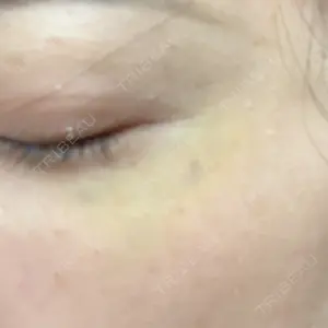PRO CLINIC プロクリニック 銀座院口コミ