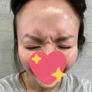 TCB東京中央美容外科 TCB東京中央美容外科 福岡天神院口コミ