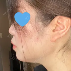 口コミ