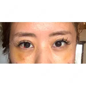 藤・ナチュレ美容クリニック 藤・ナチュレ美容クリニック 銀座院口コミ