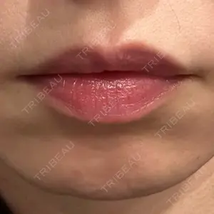 口コミ