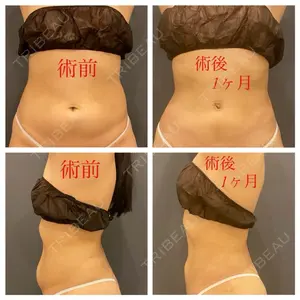 オアシス美容外科口コミ