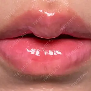 R Beauty CLINIC R Beauty CLINIC 銀座院口コミ
