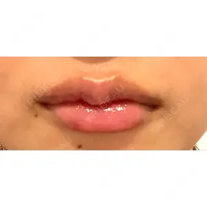 R Beauty CLINIC R Beauty CLINIC 銀座院口コミ