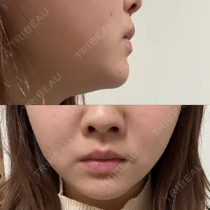 TCB東京中央美容外科 TCB東京中央美容外科 新宿東口院口コミ