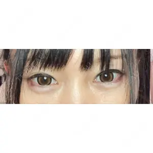 AI Beauty Clinic （エーアイ美容クリニック）口コミ