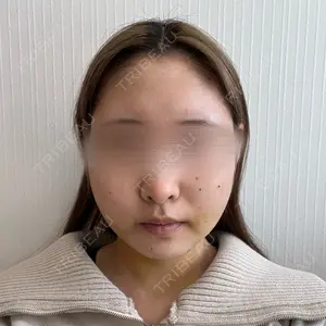 口コミ