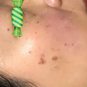 ミセルクリニックの口コミ