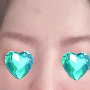 PRO CLINIC プロクリニック 銀座院口コミ