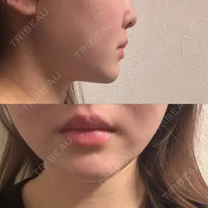 TCB東京中央美容外科 TCB東京中央美容外科 新宿東口院口コミ