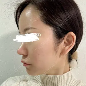 口コミ