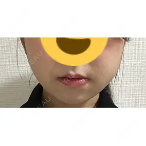 湘南美容クリニック 湘南美容クリニック 銀座院口コミ