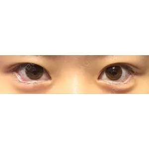 口コミ