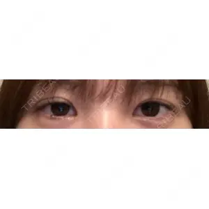 聖心美容クリニック 銀座院口コミ