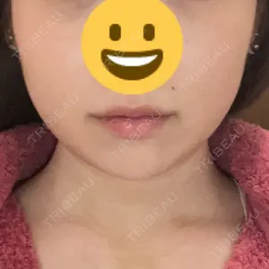 A CLINIC（エークリニック） A CLINIC（エークリニック） 池袋院口コミ