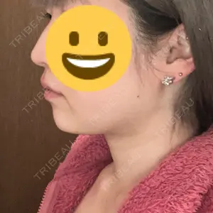 A CLINIC（エークリニック） A CLINIC（エークリニック） 池袋院口コミ