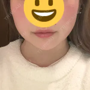 A CLINIC（エークリニック） A CLINIC（エークリニック） 池袋院口コミ